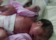 去北安市看卵巢早衰治疗医院哪家好？试管医院情况清清楚楚