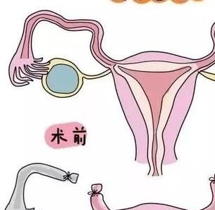 金华三代试管怀孕生孩子多少钱？