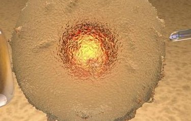 在四会市做试管婴儿长方案周期需要多久？超长方案促排流程是怎么样的？