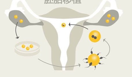 郴州市南院三代试管婴儿的成功率如何？详细成功率介绍